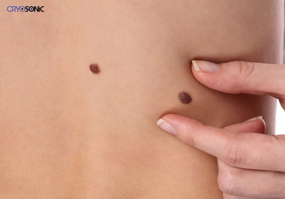 Infection Risk and Poor Aftercare Sutton-in-Ashfield