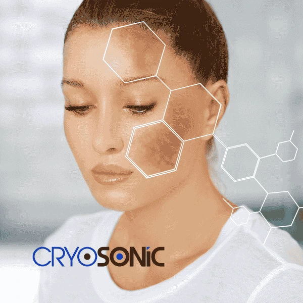 Are you looking for age spot removal treatment? Contact Cryosonic today in Sutton-in-Ashfield