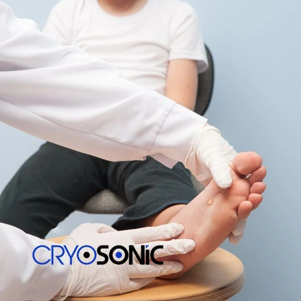 Are you looking for fast effective wart removal Contact us today Sutton-in-Ashfield