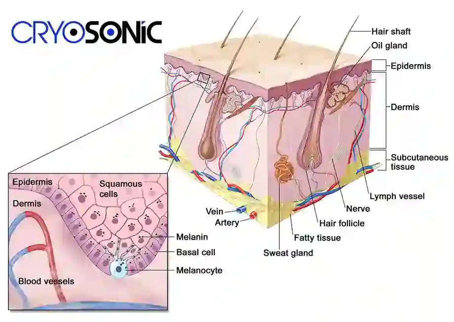 How Cryotherapy Stimulates Melanocyte Activity Sutton-in-Ashfield